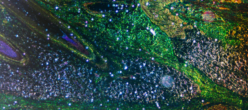 Thumbnail for Mitochondrial dysfunction