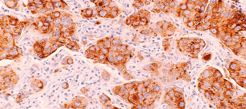 Thumbnail for Understanding Metabolic Energy: The Role of Mitochondria in Your Health