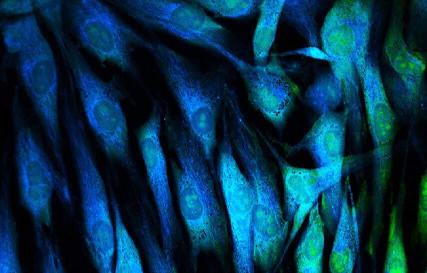 Skin cells