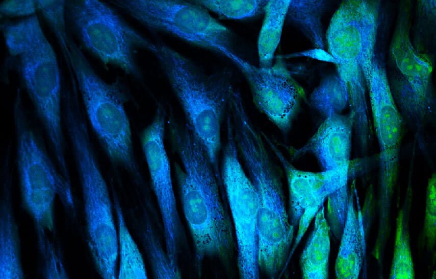 Skin cells