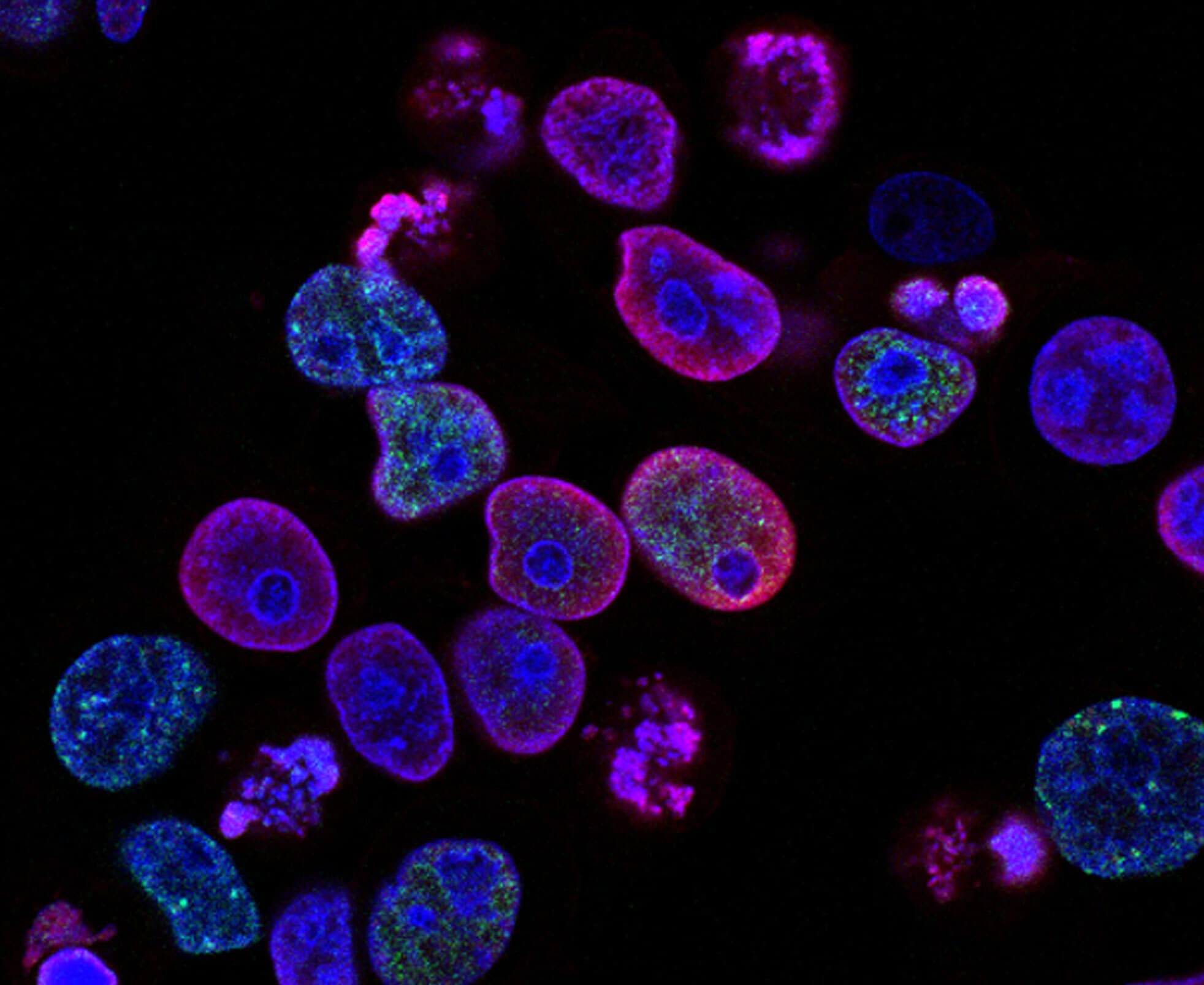 Bacteria under microscope