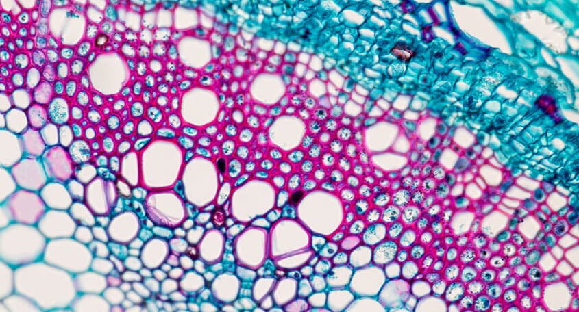 Cell under microscope