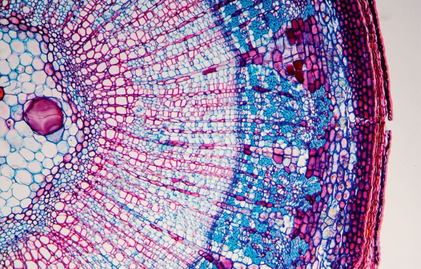 a magnified image of part of a cell
