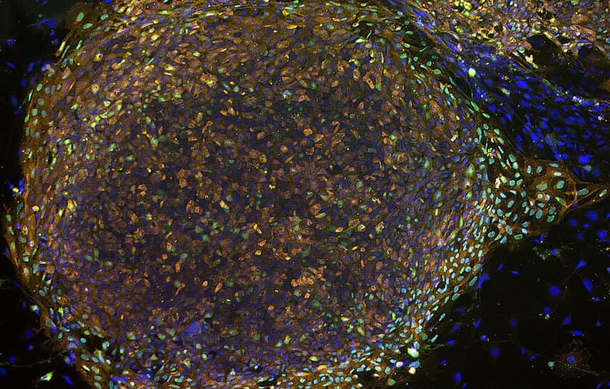 stem cells