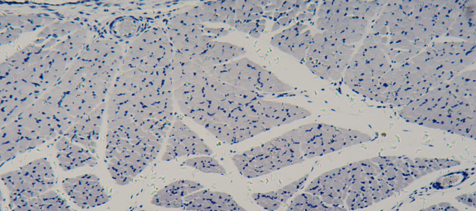 Human cells