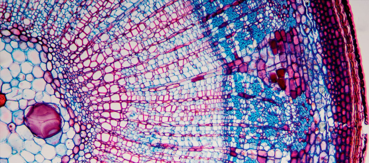 5 examples of cellular stress