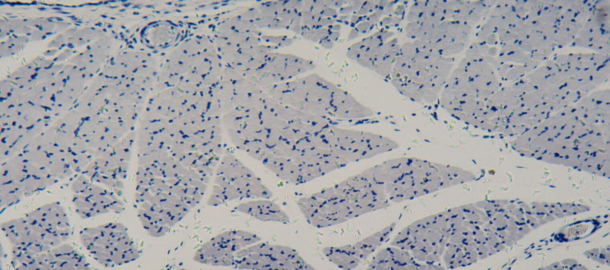 What happens to your cells as you age?